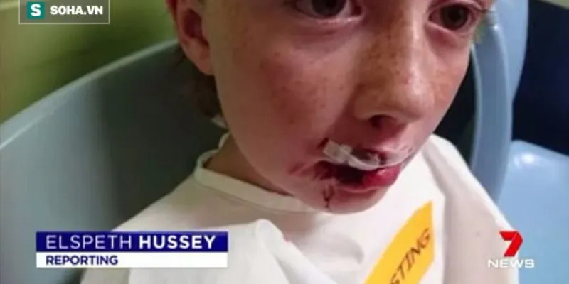 Bị Chó Dữ Cắn