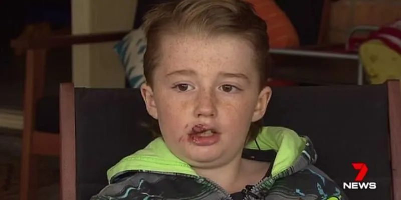 Bị Chó Dữ Cắn